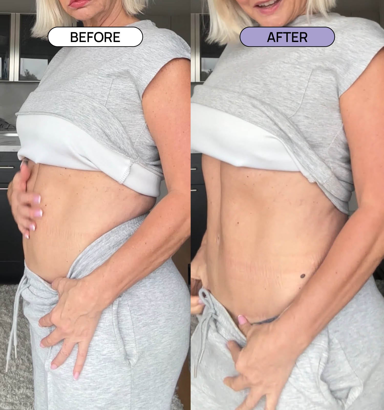 De-bloat