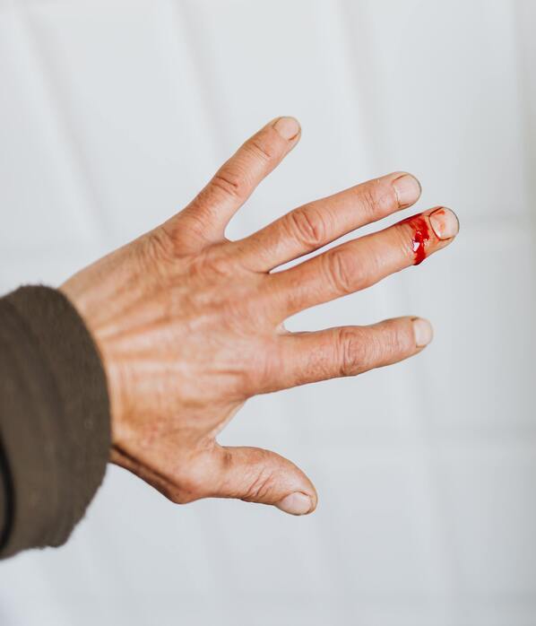 What is inflammation?: A beginners guide