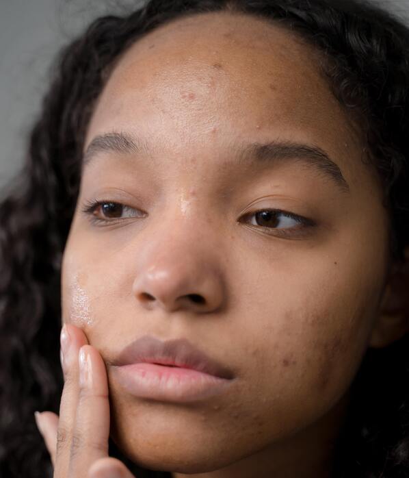 Can Probiotics Improve Your Skin? Exploring the Gut-Skin Axis